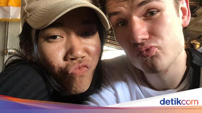 Kisah seorang wanita Indonesia yang mendapatkan pasangan bule Jerman yang wajahnya berjerawat