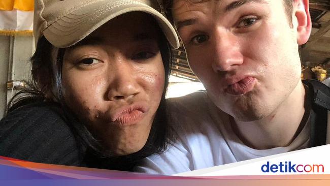 Viral kisah seorang wanita Indonesia yang mendapatkan pasangan bule Jerman yang wajahnya berjerawat Viral kisah seorang wanita Indonesia yang mendapatkan pasangan bule Jerman yang wajahnya berjerawat