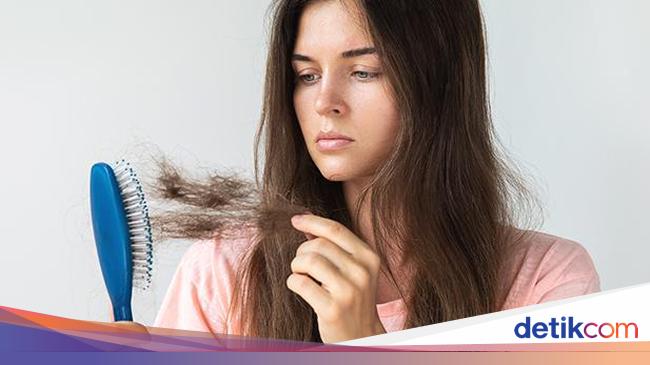 Hati-hati! Sering Minum Soda Bisa Memicu Kerontokan Rambut