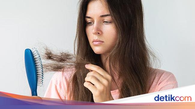 Rambut Rontok Kekurangan Vitamin Apa? Coba Cek di Sini