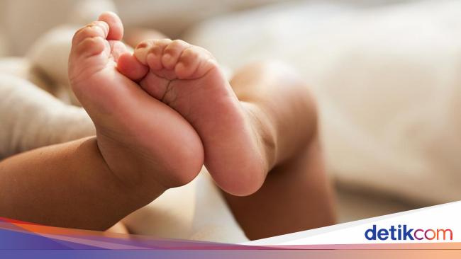 Baby Hospitalized After Alleged Hot Water Attack by Mother in Bogor