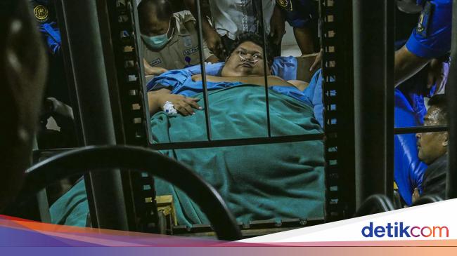 Obesity-related Death: Muhammad Fajri Dies of Organ Failure from Septic Shock