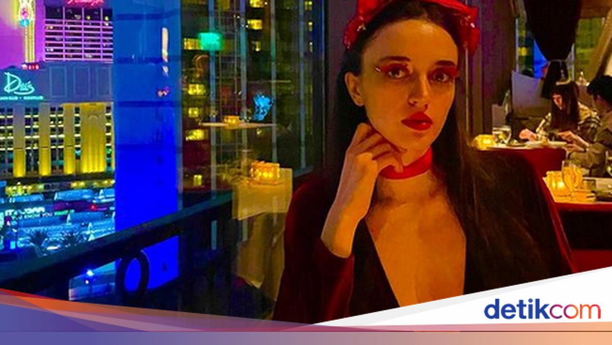 Foto: Eks Model Makan Kapas Demi Langsing, Pernah Sekurus Ini