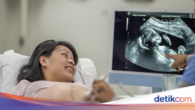 Cara Membaca Hasil Usg Yang Tepat Dan Benar Penting Untuk Bumil