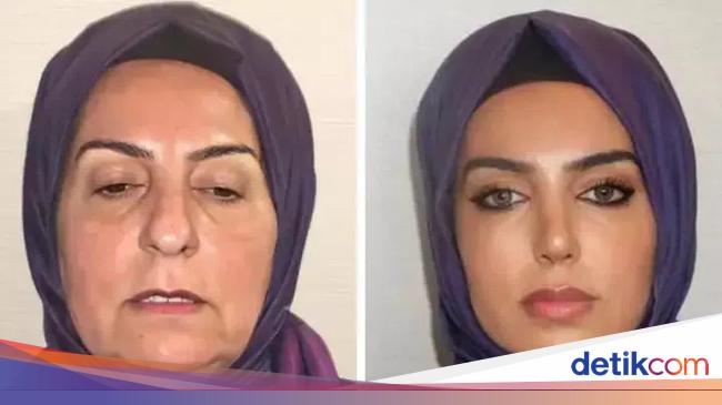 Breathtaking Transformation of a 68-Year-Old Woman with Plastic Surgery – TikTok Goes Viral