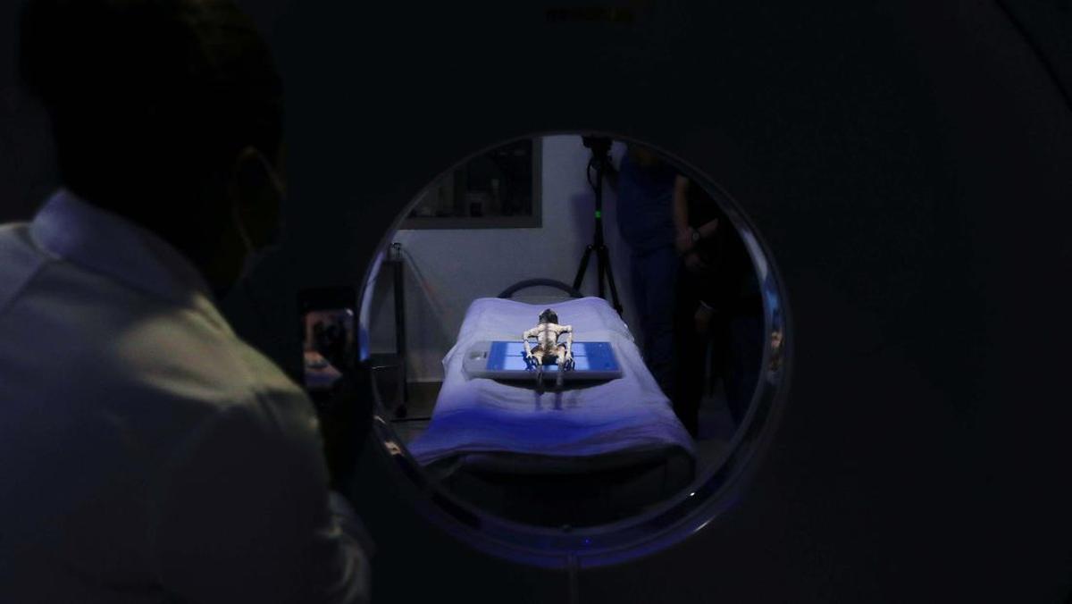 Jasad 'Alien' Jalani CT Scan, Dokter Meksiko Klaim Bukan Buatan Manusia