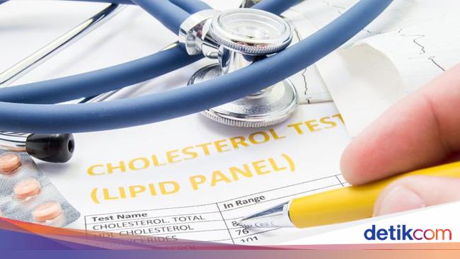 Early Symptoms of High Cholesterol and Natural Ways to Overcome It – Indonesian Ministry of Health