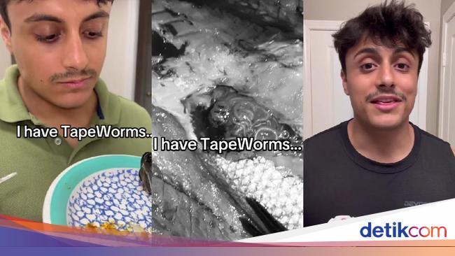 Man Eats Tapeworm: Shocking Video Goes Viral