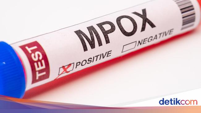 Varian Mpox Mematikan 'Clade 1b' Muncul di Thailand, Ini Gejala yang Dikeluhkan