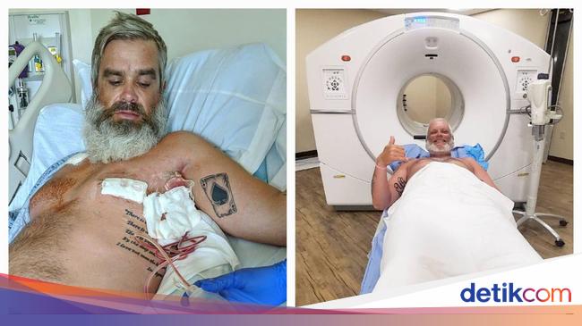 Cerita Pria Kena Kanker Payudara Stadium 4, Sempat Mengira Lelaki Tak