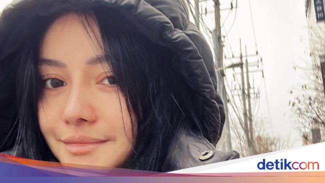 Selain Operasi Hidung, Mawar AFI Juga 'Cafe Hopping' Saat di Korea