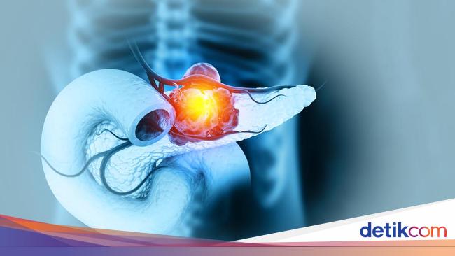 Sering Dikonsumsi buat Diet, Ternyata Tanaman Ini Bisa Lawan Kanker