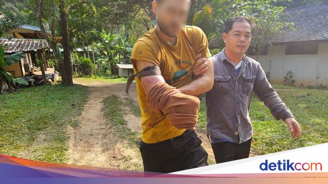 ボランティア中にクマに噛まれたスイス人男性、自らの手を切断することを選択