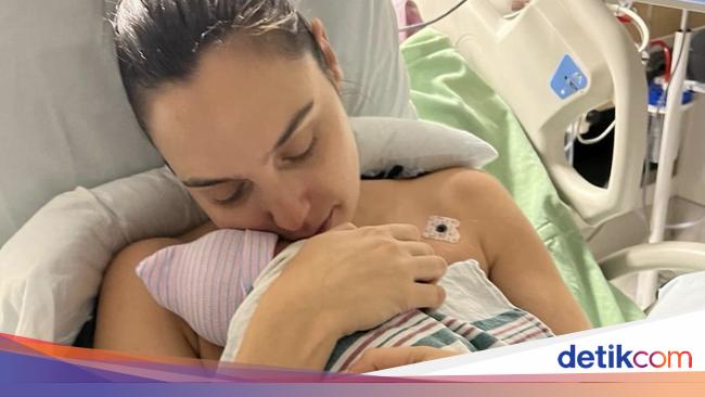 Gal Gadot Alami Pembekuan Darah di Otak saat Hamil, Melahirkan Darurat