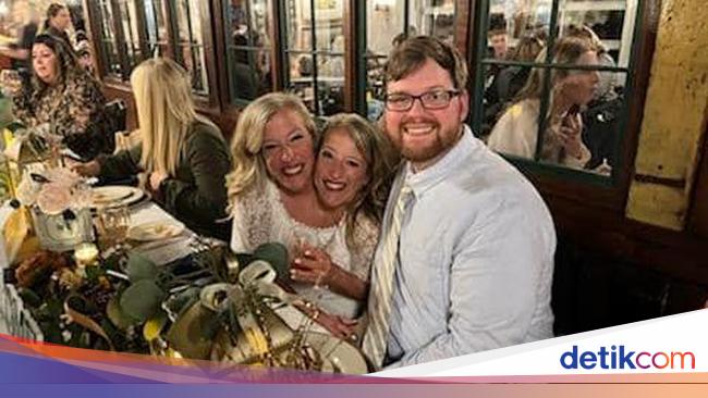 Conditions Behind the Viral Story of Conjoined Twins, Abby Hensel