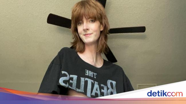 Curhat Wanita dengan Kaki Terpanjang 1,3 Meter, Dihina Mirip Pemain Horor