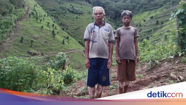 Mengenal Keunikan Suku Tobalo: Warna Kulitnya Belang-belang