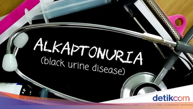 Alkaptonuria, Penyebab dan Gejala