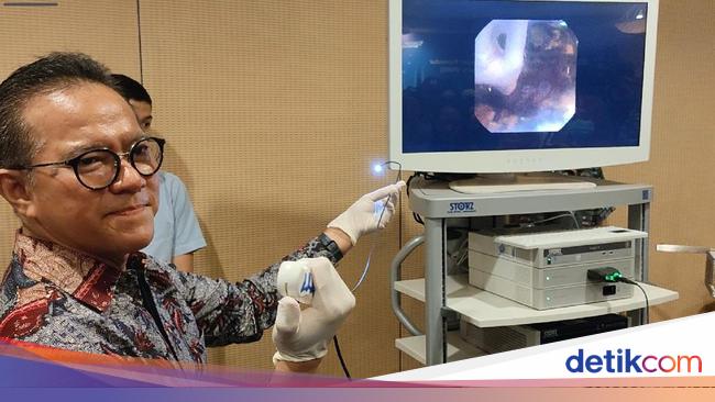 Metode RIRS untuk Pengobatan Batu Ginjal, Minim Invasif-Pasien Cepat Pulih