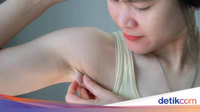 10 Penyebab Kelenjar Getah Bening Membengkak dan Cara Mengatasinya