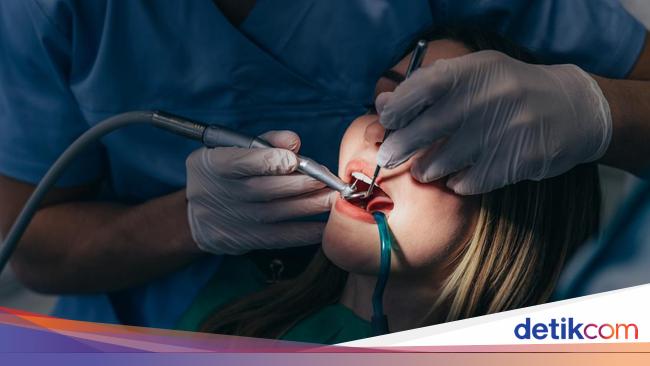 Apakah Pasang Gigi Palsu Bisa Pakai BPJS? Ini Penjelasannya