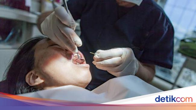 Cabut Gigi Bagian Atas Berisiko Sebabkan Kebutaan? Begini Kata Dokter