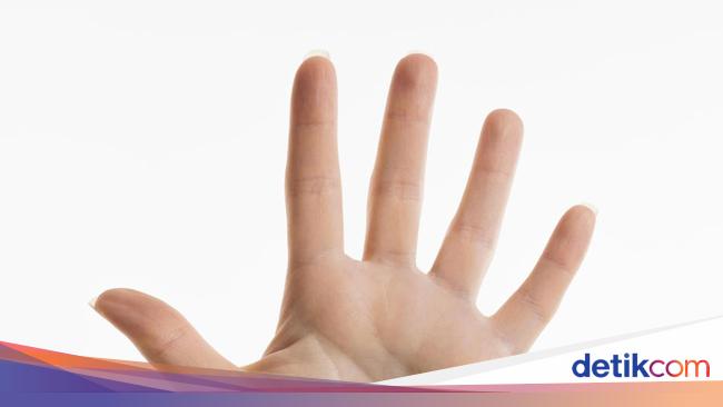 Penyebab 4 Jari Nenek Muniah Diamputasi gegara Lomba Tarik Tambang HUT RI