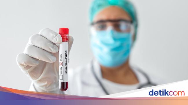 Angkasa Pura Pasang Pengukur Suhu di Bandara Cegah Virus Mpox
