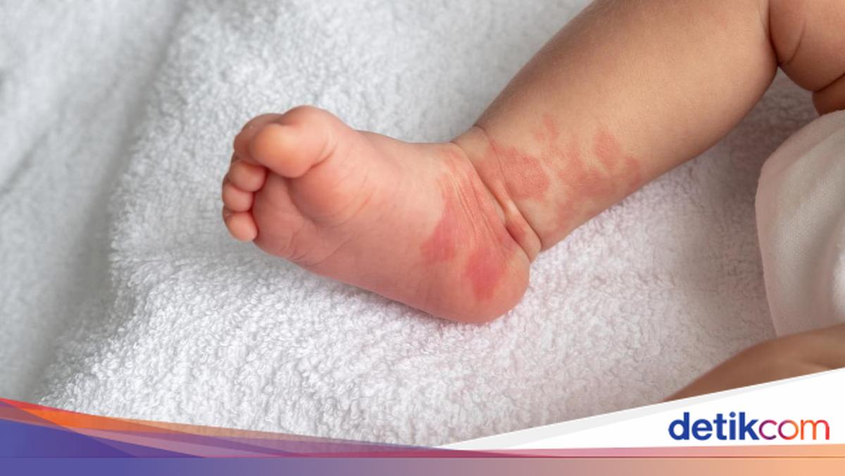 Polisi Ungkap Kondisi Bayi yang Dibuang Ibunya ke Tempat Sampah di Jakut