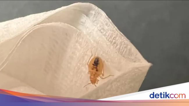 Ngeri, Kutu Busuk Terlihat di Penerbangan Kelas Utama