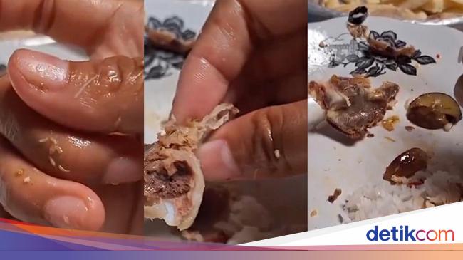 This is what happens to the body when it accidentally swallows maggots