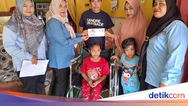 Andre Rosiade Bantu Bocah Pengidap TBC Tulang di Padang