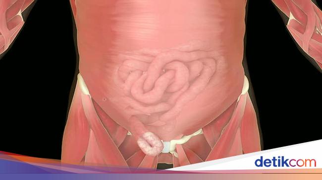 4 Cara Mengobati Turun Berok Pria, Apakah Berbahaya?