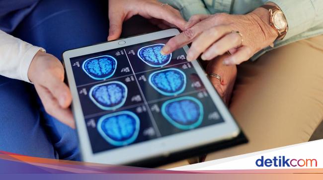 Mayapada Punya Tahir Neuroscience Center buat Atasi Gangguan Otak &amp; Saraf