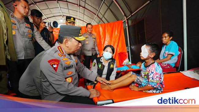 Kapolri Jenguk Anak Korban Erupsi Lewotobi di Posko Kesehatan Pengungsian