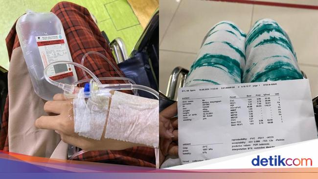 Awal Mula Wanita Jaktim Kena Pneumonia, Sempat Dikira Cuma 'Masuk Angin' Biasa