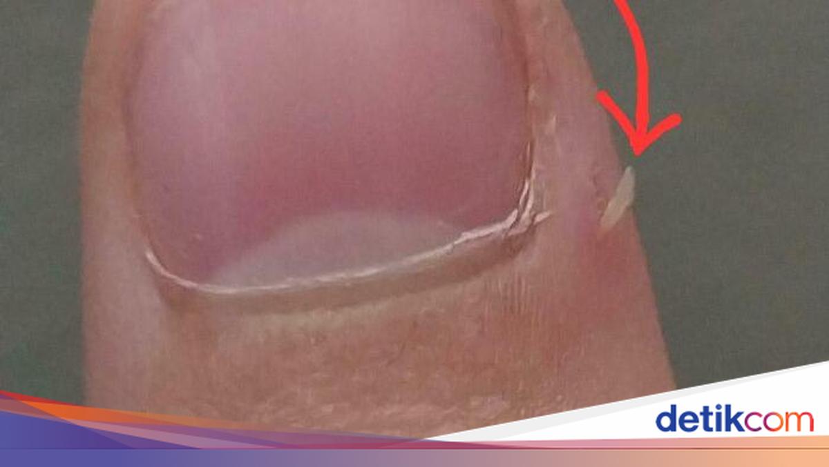 Sederhana Tapi Kejadian Ini Bikin Kamu Marah, Pernah Mengalaminya?