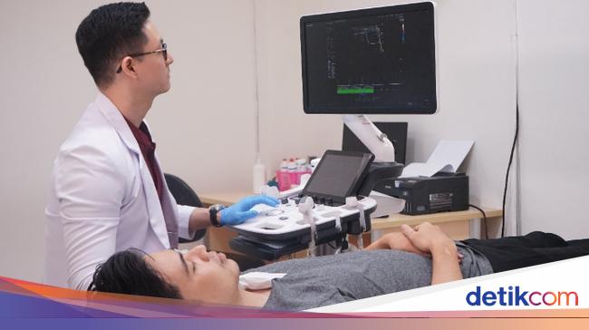 Kenali Gejala Stroke dan Penanganannya, Jangan Tunda ke Rumah Sakit