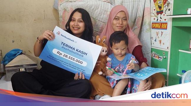 Sahabat Baik Bantu Kesembuhan Arumi, Balita Penderita Tumor Mata