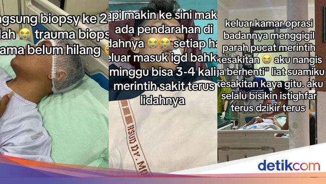 Dialami Pria Solo, Dokter Ungkap Gejala Kanker Lidah yang Muncul di Usia Muda