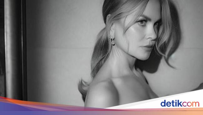 Telinga Unik Nicole Kidman Mirip Kelelawar, Apa Penyebabnya?