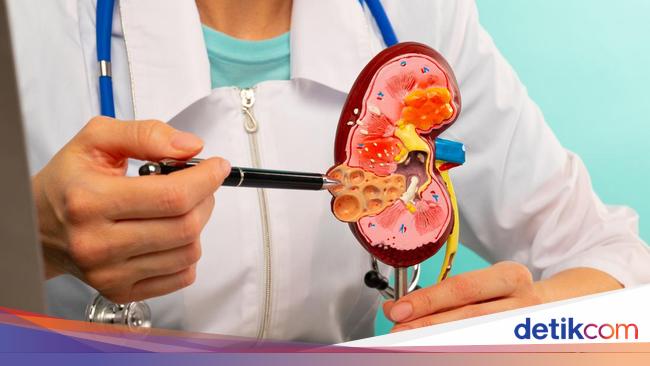 Gaya Hidup Tak Sehat Picu Lonjakan Kasus Gagal Ginjal di Indonesia