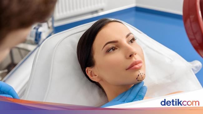 Implan Dagu Hingga Facelift Dini, Ini Tren Oplas Permak Wajah 2025