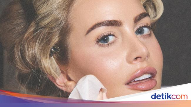 Foto Influencer Kebanyakan Filler Selama 15 Tahun, Tak Kenali Wajahnya Sendiri