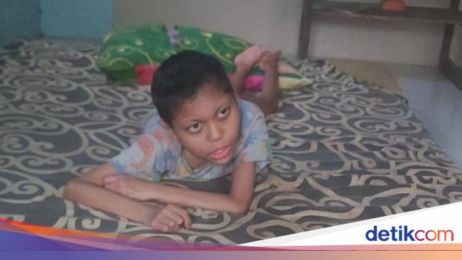 Kebutuhan Ibnu Anak Penderita Radang Otak Tercukupi Berkat Sahabat Baik