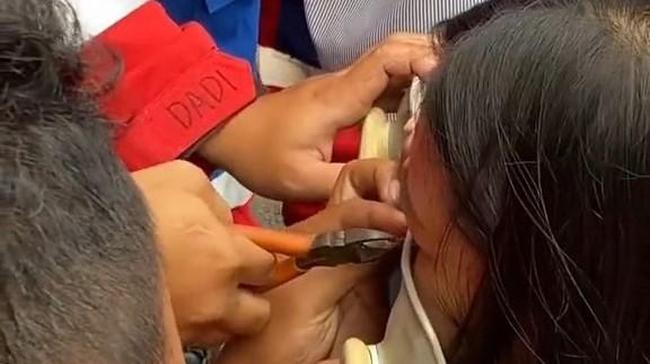 Viral Piercing Hidung Wanita di Bandung Nyangkut Kursi, Damkar Turun Tangan