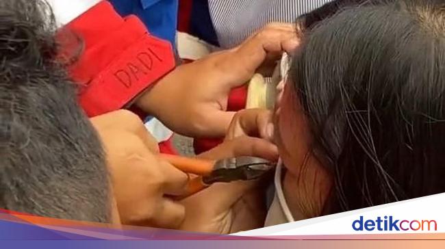 Viral Piercing Hidung Wanita di Bandung Nyangkut Kursi, Damkar Turun Tangan