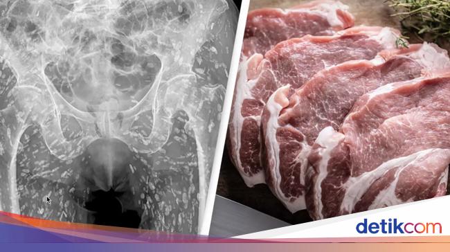 Dokter Ini Ungkap Kondisi Tubuh Orang yang Doyan Daging Babi Mentah