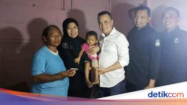 Polda DIY Bantu Pengangkatan Tumor Balita Ningsih