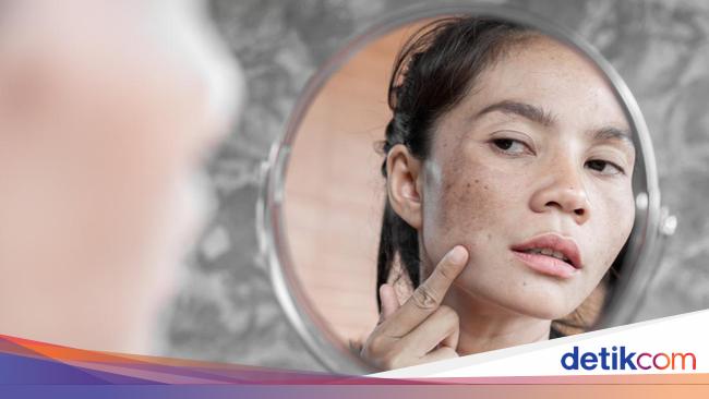 Waspadai Skincare Bermerkuri: Ciri-ciri dan Bahaya untuk Kulit